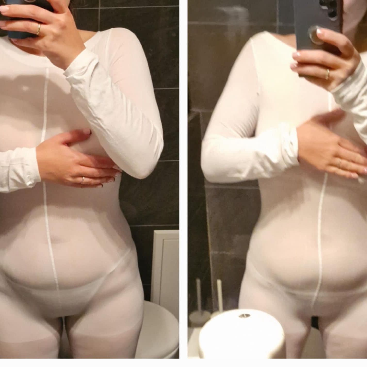 Efekt przed i po serii zabiegów endermologii Contour