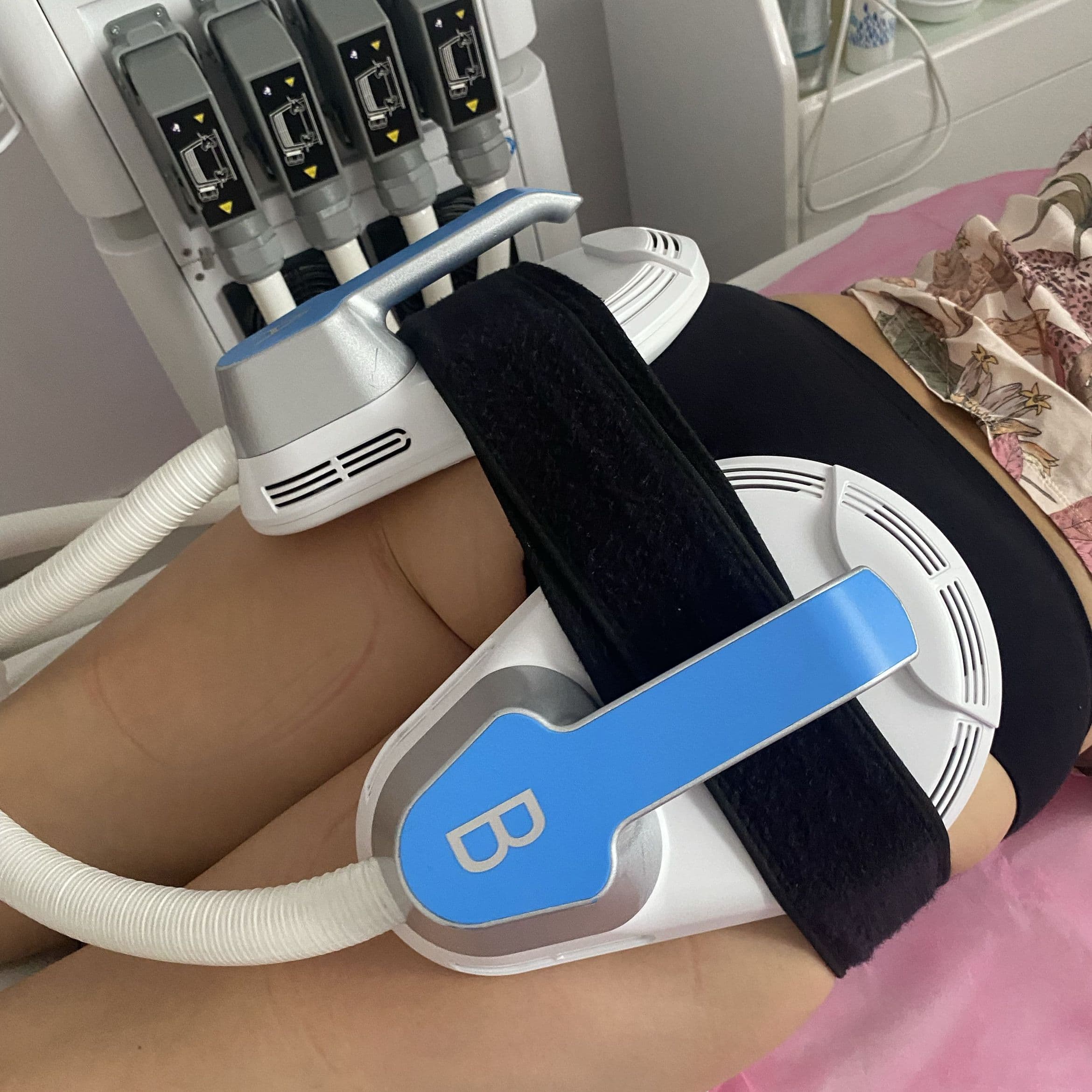 Zabieg modelujący sylwetkę na urządzeniu Body Sculptor EMS