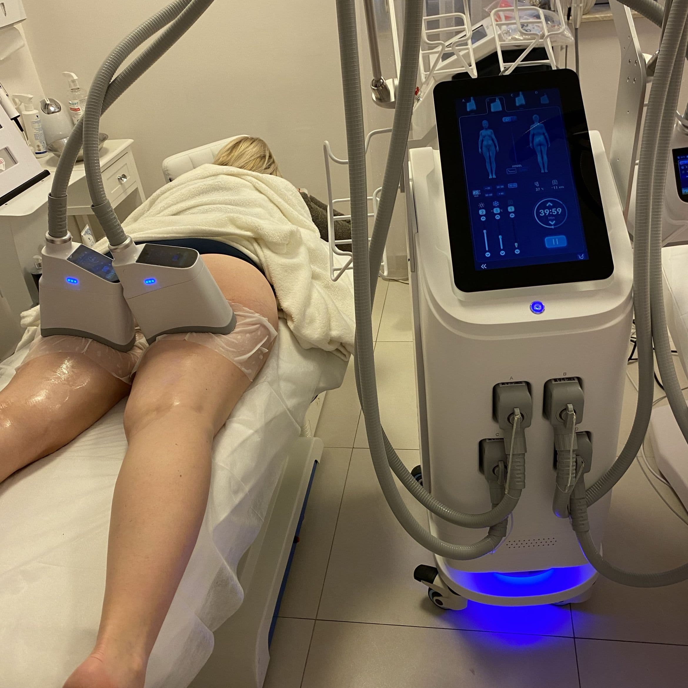 Zabieg kriolipolizy CryoCell modelujący sylwetkę w Studiu Urody Iwona Cieślińska
